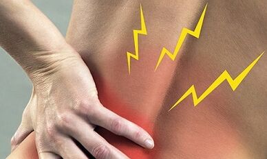 Sintomas de osteocondrose lombar